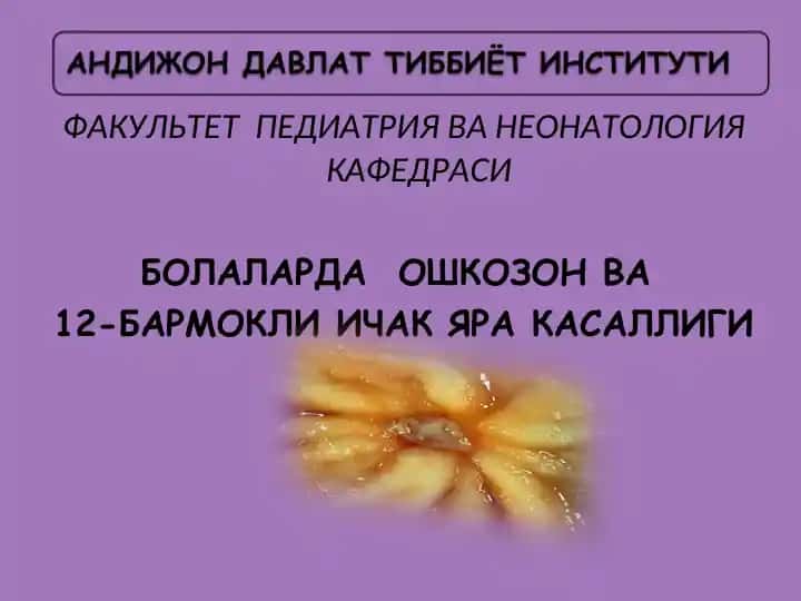 Яра касаллиги
