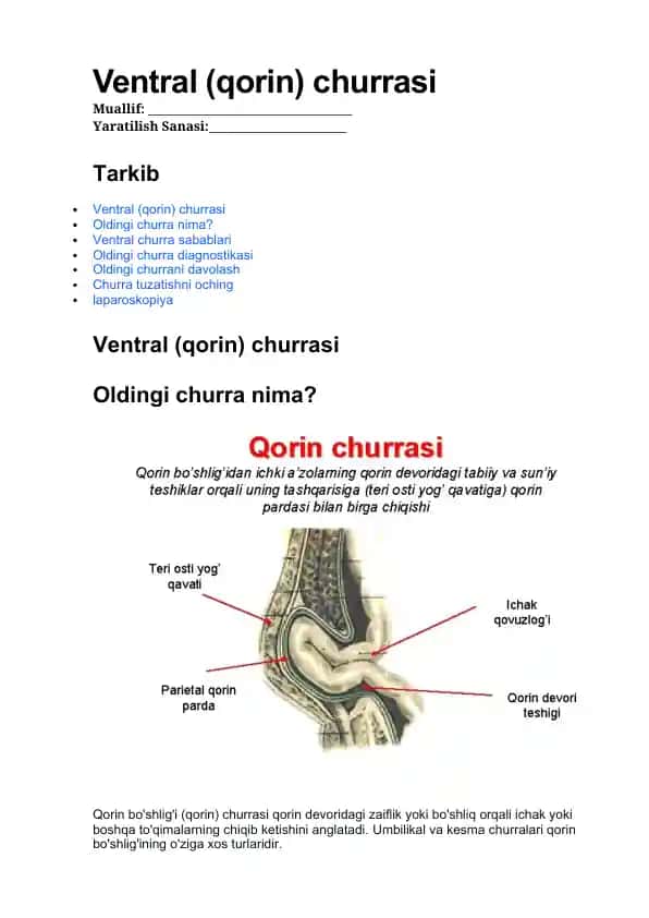 Ventral (qorin) churrasi