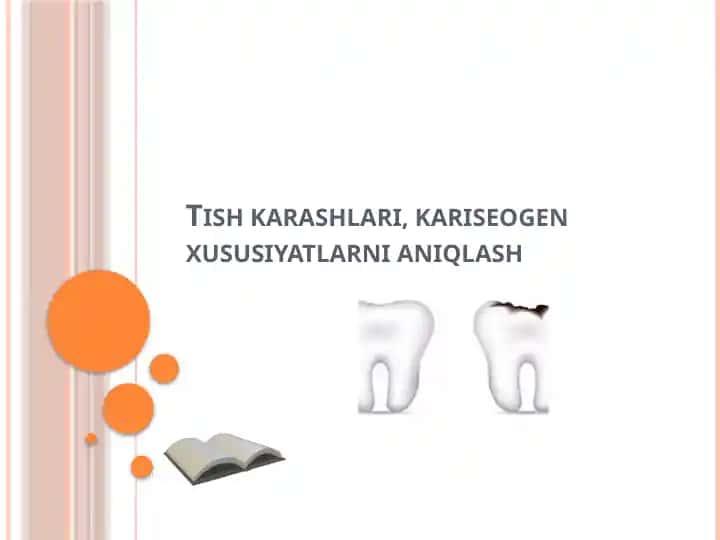 Tish toshlari