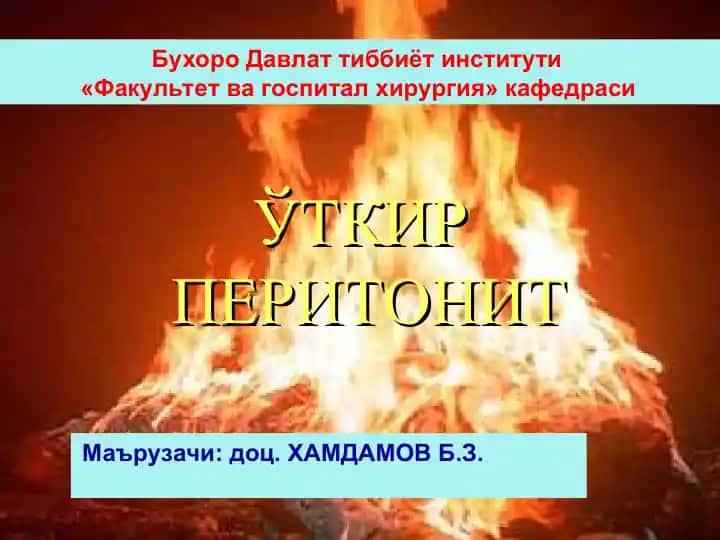 ЎТКИР ПЕРИТОНИТ