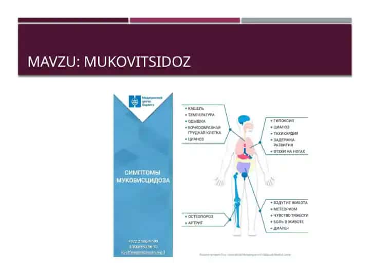 Mukovistsidoz (kistik fibroz)