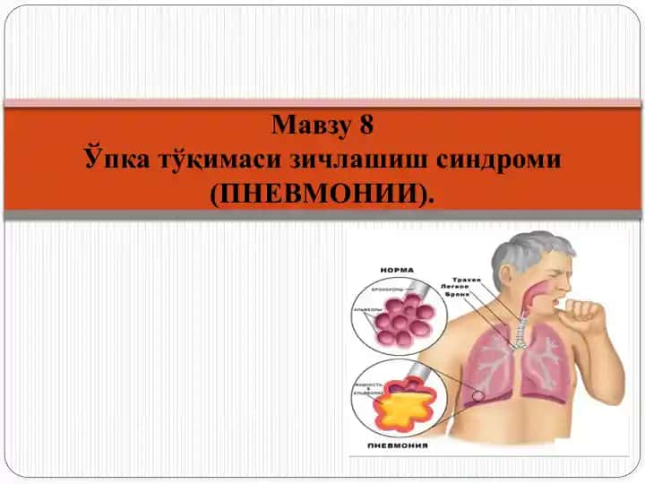Ўпка тўқимаси зичлашиш синдроми(ПНЕВМОНИИ)