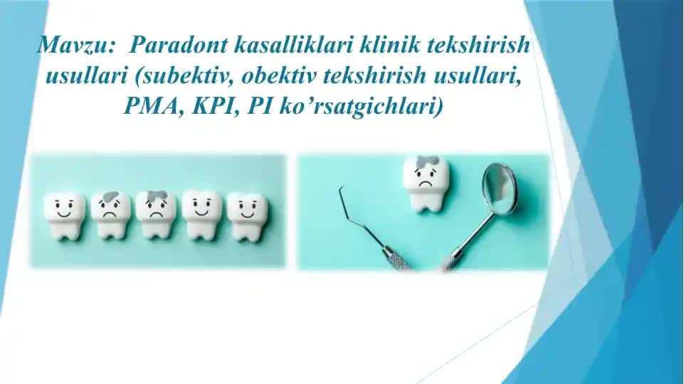 Paradont kasalliklari klinik tekshirish usullari (subektiv, obektiv tekshirish usullari, PMA, KPI, PI ko’rsatgichlari)