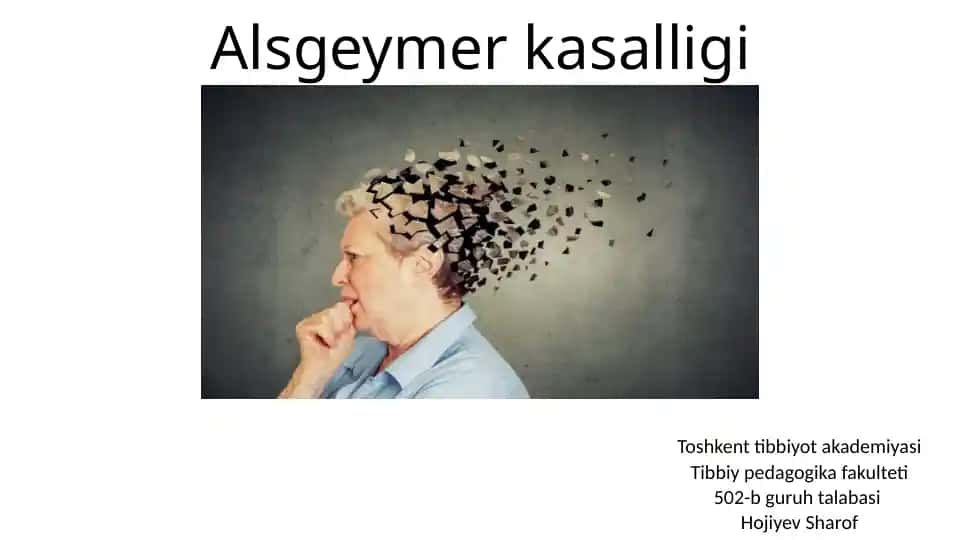 Altsgeymer kasalligi