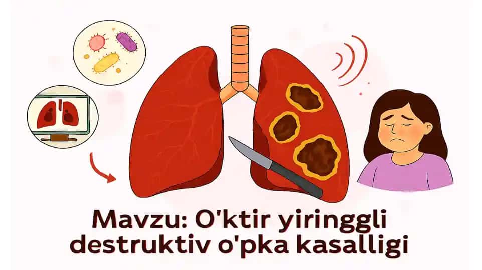 O'ktir yiringgli destruktiv o'pka kasalligi