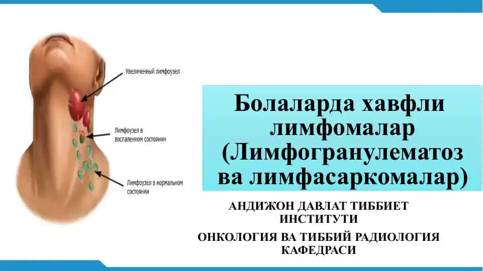 Лимфогранулематозвалимфасаркомалар
