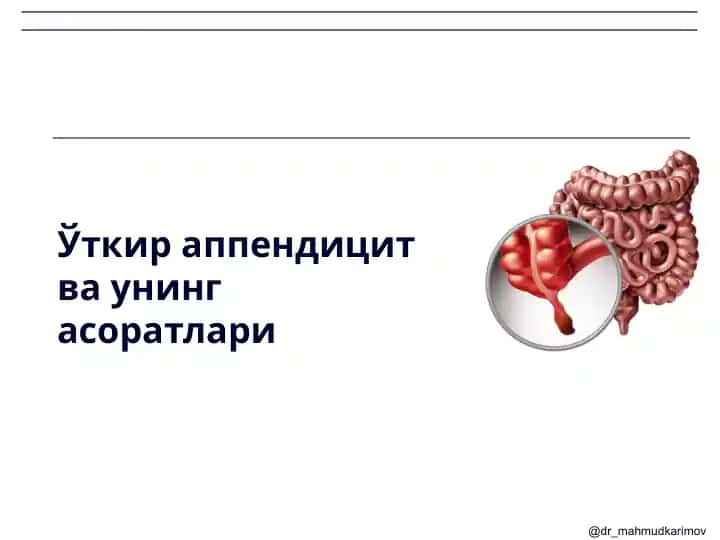 Ўткир аппендицит ва унинг асоратлари