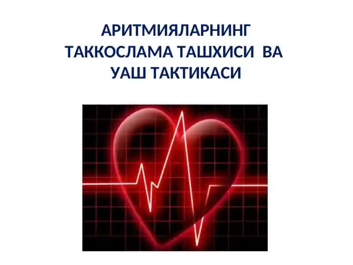 Aritmialarni Takkoslama Tashhisi va Uash Taktikasi