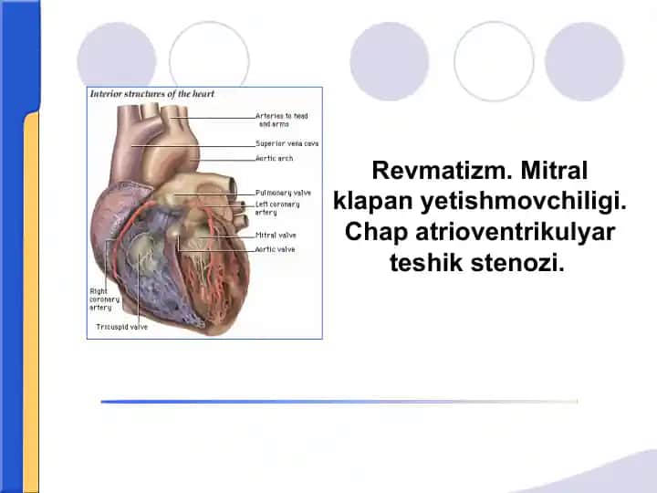 Revmatizm