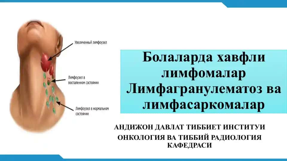 Лимфогранулематоз ва лимфасаркомалар