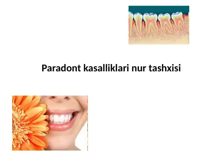 Paradont kasalliklari nur tashxisi