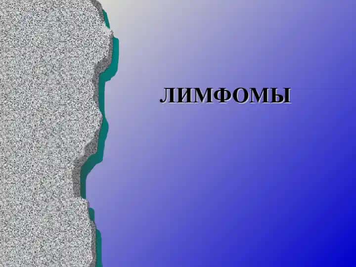 Лимфомы