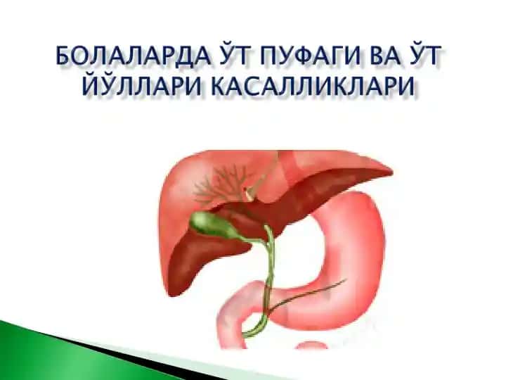 Холецистит