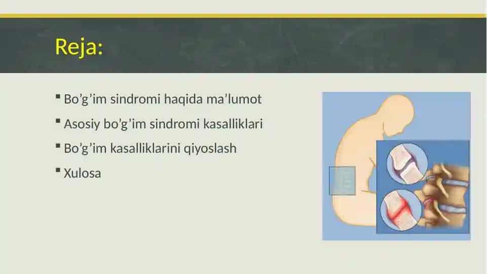 Bo’g’im sindromi