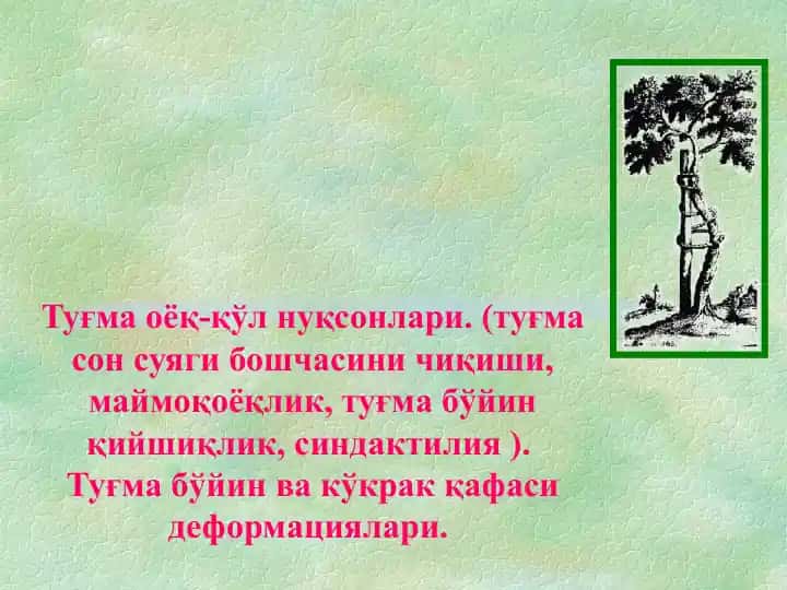 Туғма оёқ-қўл нуқсонлари