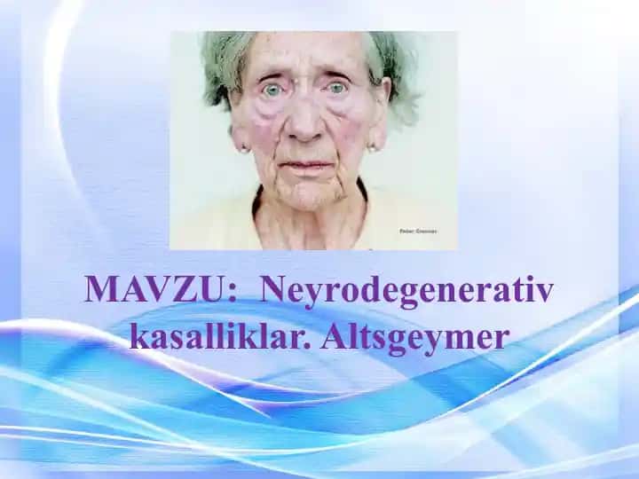Neyrodegenerativ kasalliklar. Altsgeymer