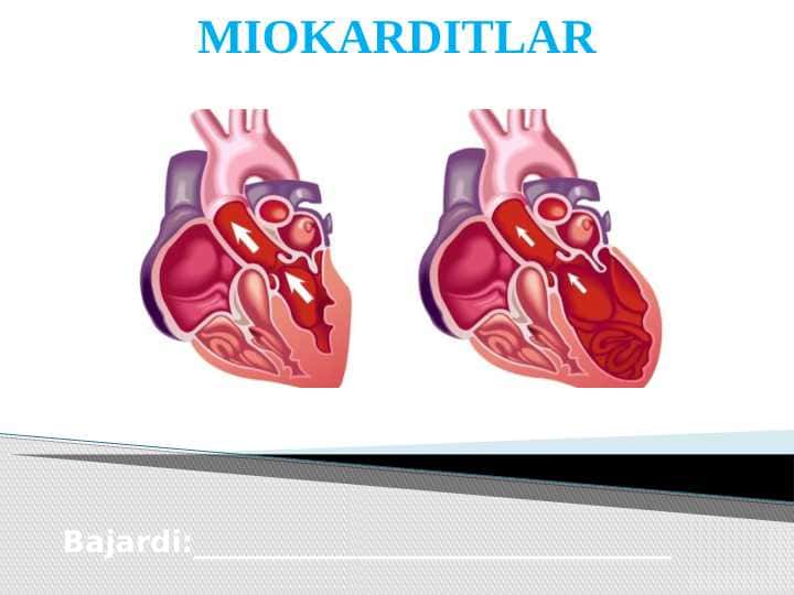 Miokarditlar