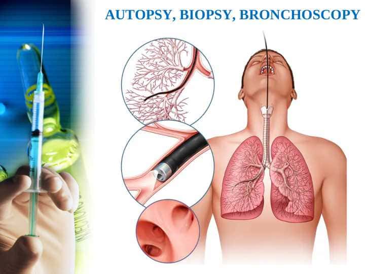 Autopsy, Biopsy, Bronchoscopy