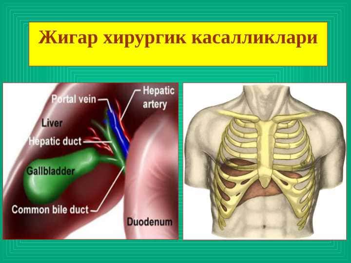 Jigar xirurgik kasalliklari ppt