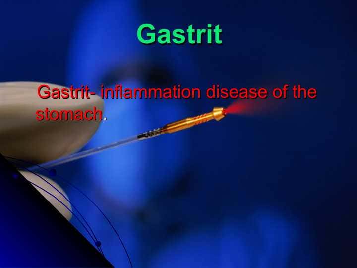 Gastrit- inflammation disease of the stomach