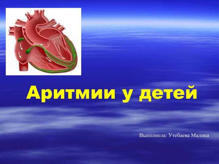 Аритмии у детей
