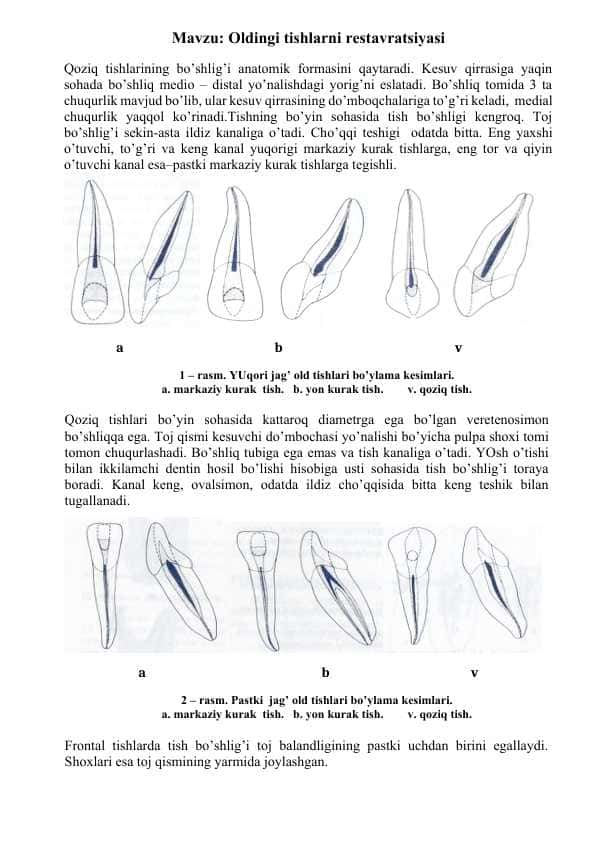 Oldingi tishlarni restavratsiyasi