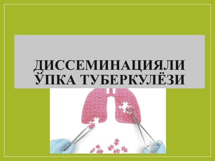 Disseminatsiyali opka tuberkulyozi ДИССЕМИНАЦИЯЛИ ЎПКА ТУБЕРКУЛЁЗИ