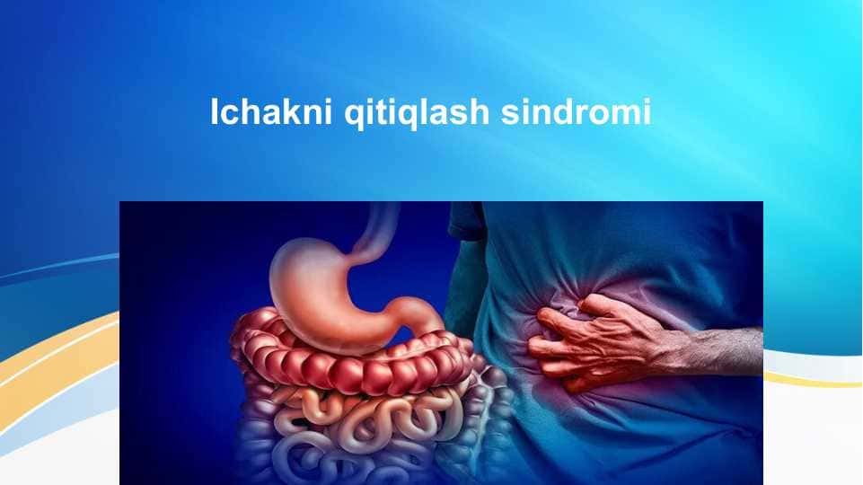 Ichakni qitiqlash sindromi . Irritable bowel syndrome