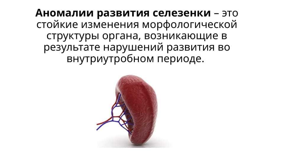 Аномалии развития селезенки