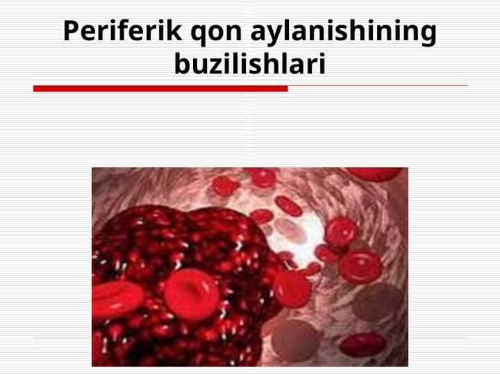 Periferik qоn аylanishining buzilishlari