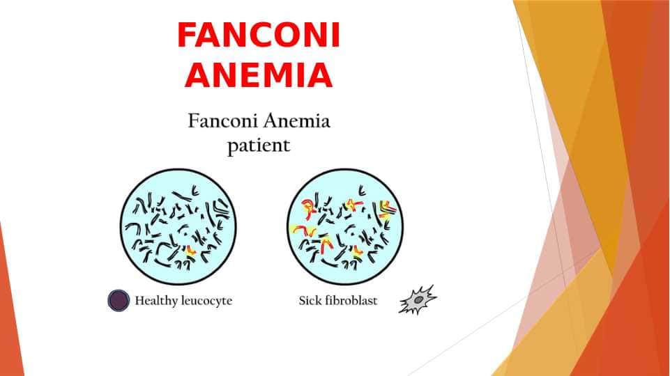 FANCONI ANEMIA