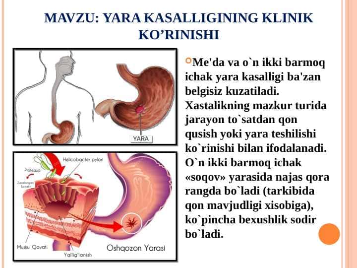 YARA KASALLIGINING KLINIK KO’RINISHI