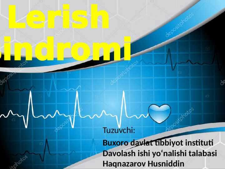 Lerish sindromi