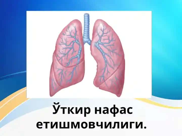 Ўткир нафас етишмовчилиги. O'tkir nafas yetishmovchiligi