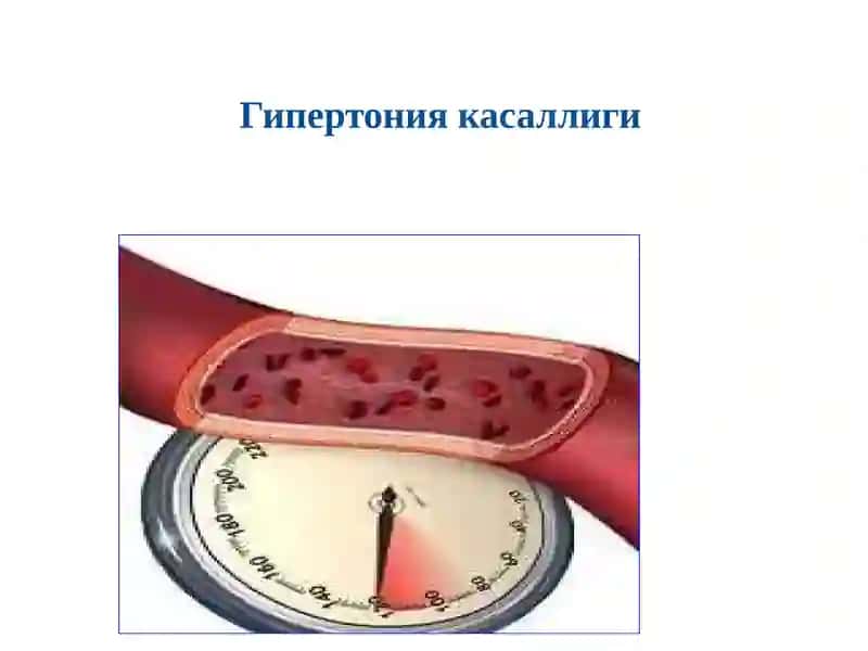 Гипертония касаллиги