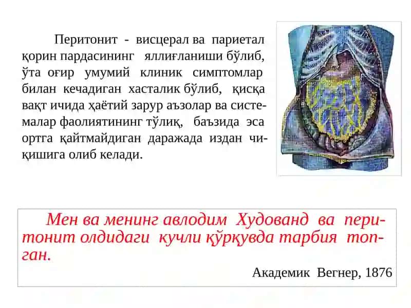 Ўткир перитонит