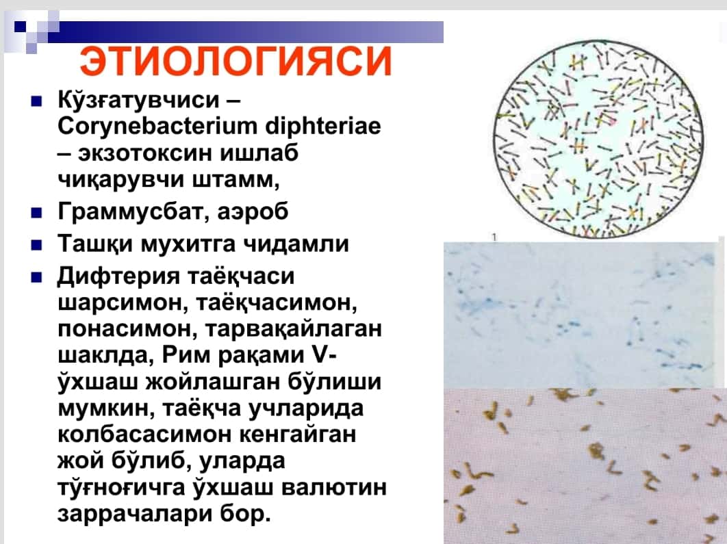 Difteriya