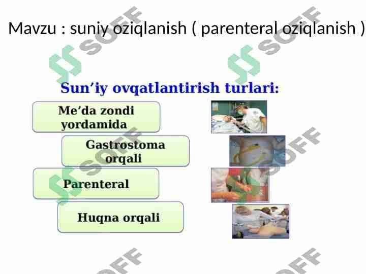suniy oziqlanish ( parenteral oziqlanish )