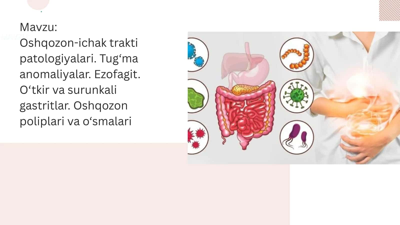 Oshqozon ichak tarkti patolohiyalari.Tug‘ma anomaliyalar. Ezofagit. O‘tkir va surunkali gastritlar. Oshqozon poliplari va o‘smalari