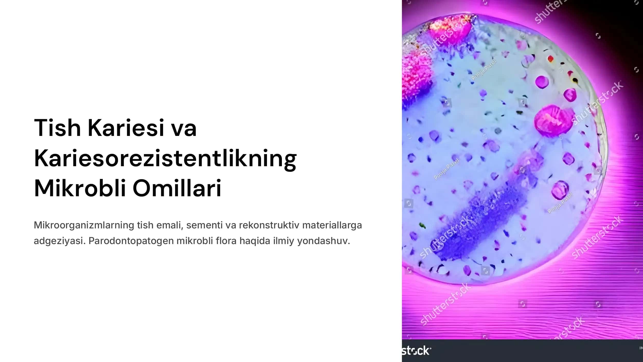 Tish kariesi va kariesorezistentlikning mikrobli omillari. Mikroorganizmlarning tish emali, sementi va rekonstruktiv materiallarga adgeziyasi. Parodontopatogen mikrobli flora.