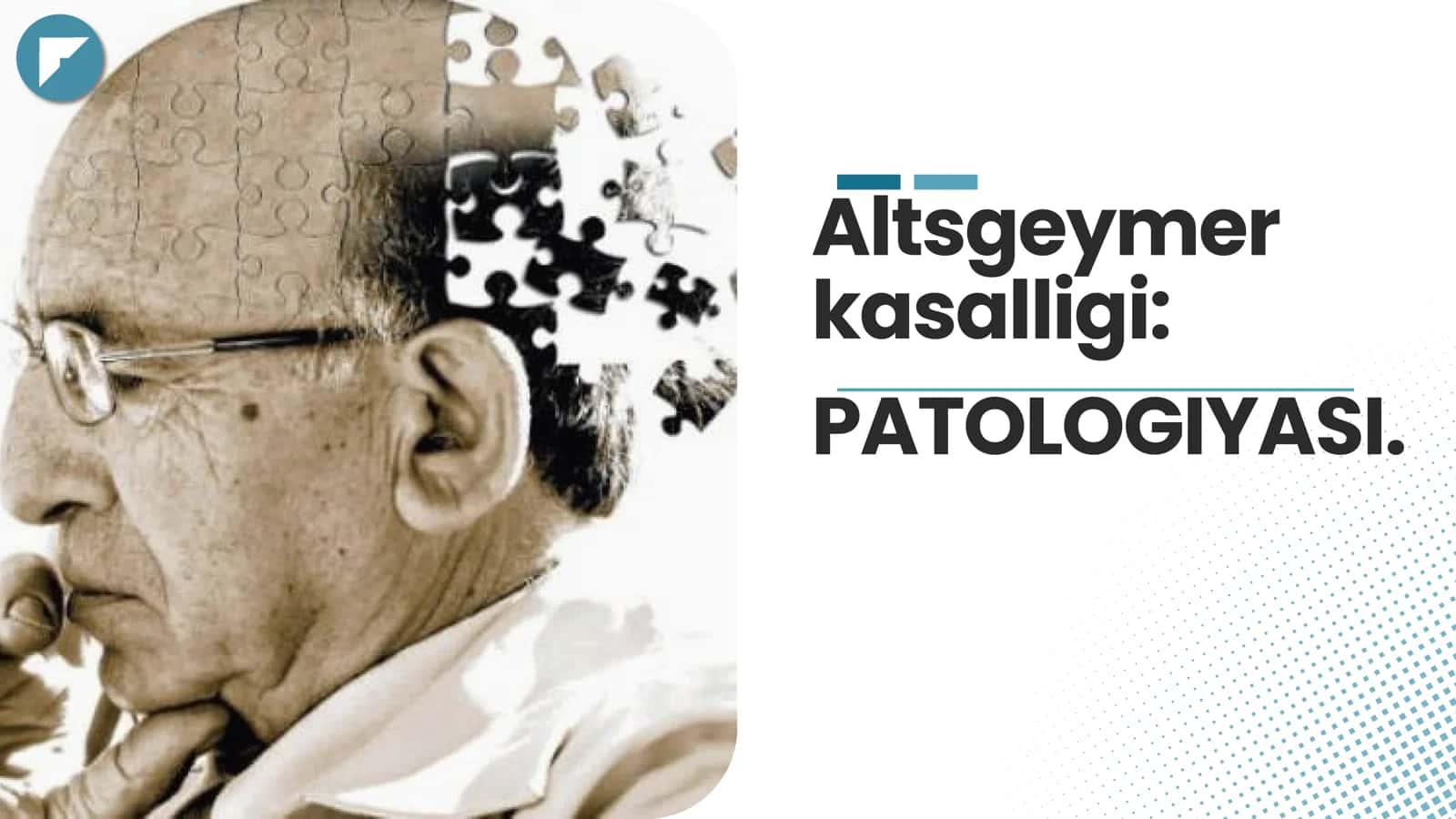 Altsgeymer kasalligi patologiyasi