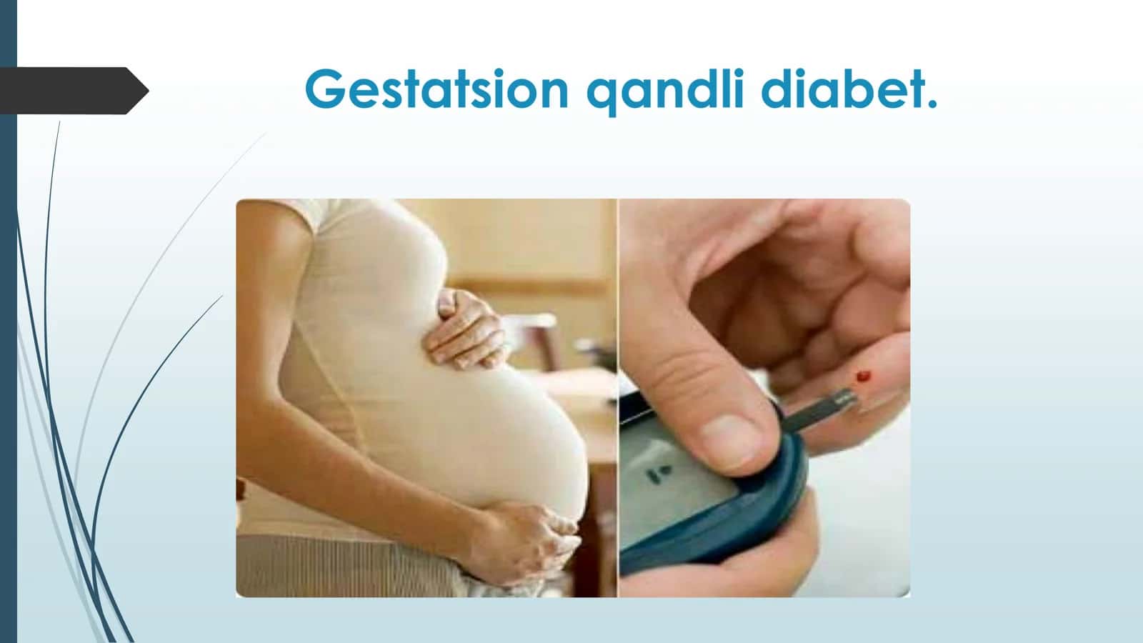 Gestatsion qandli diabet