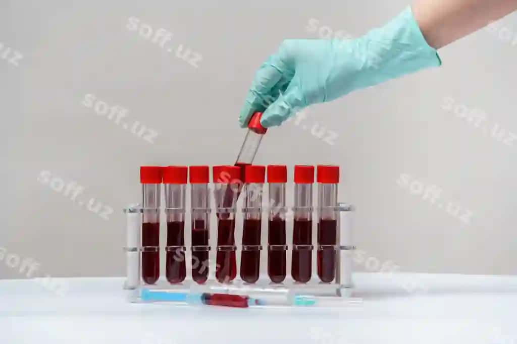 Rakovinadagi tubalar qon namunalari test qilish biologik material | Rack tubes blood sample testing biological material