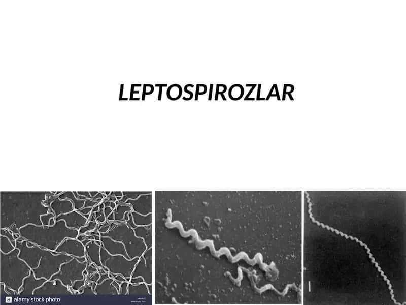 LEPTOSPIROZLAR