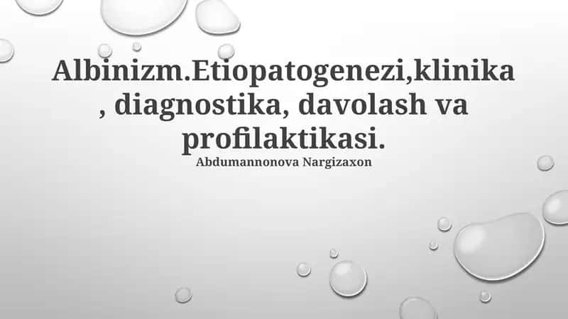 Albinizm