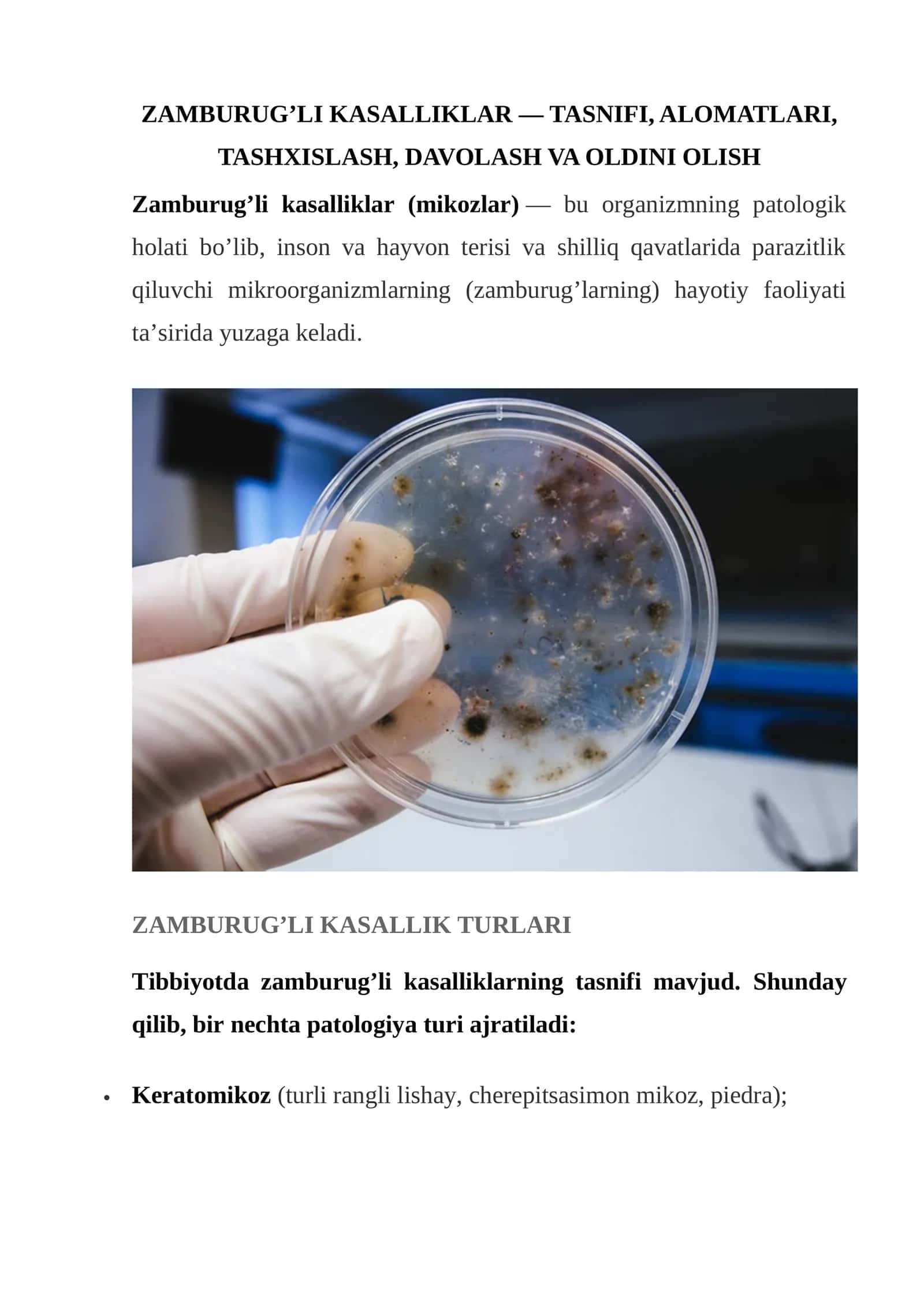 ZAMBURUG’LI KASALLIKLAR — TASNIFI, ALOMATLARI, TASHXISLASH, DAVOLASH VA OLDINI OLISH