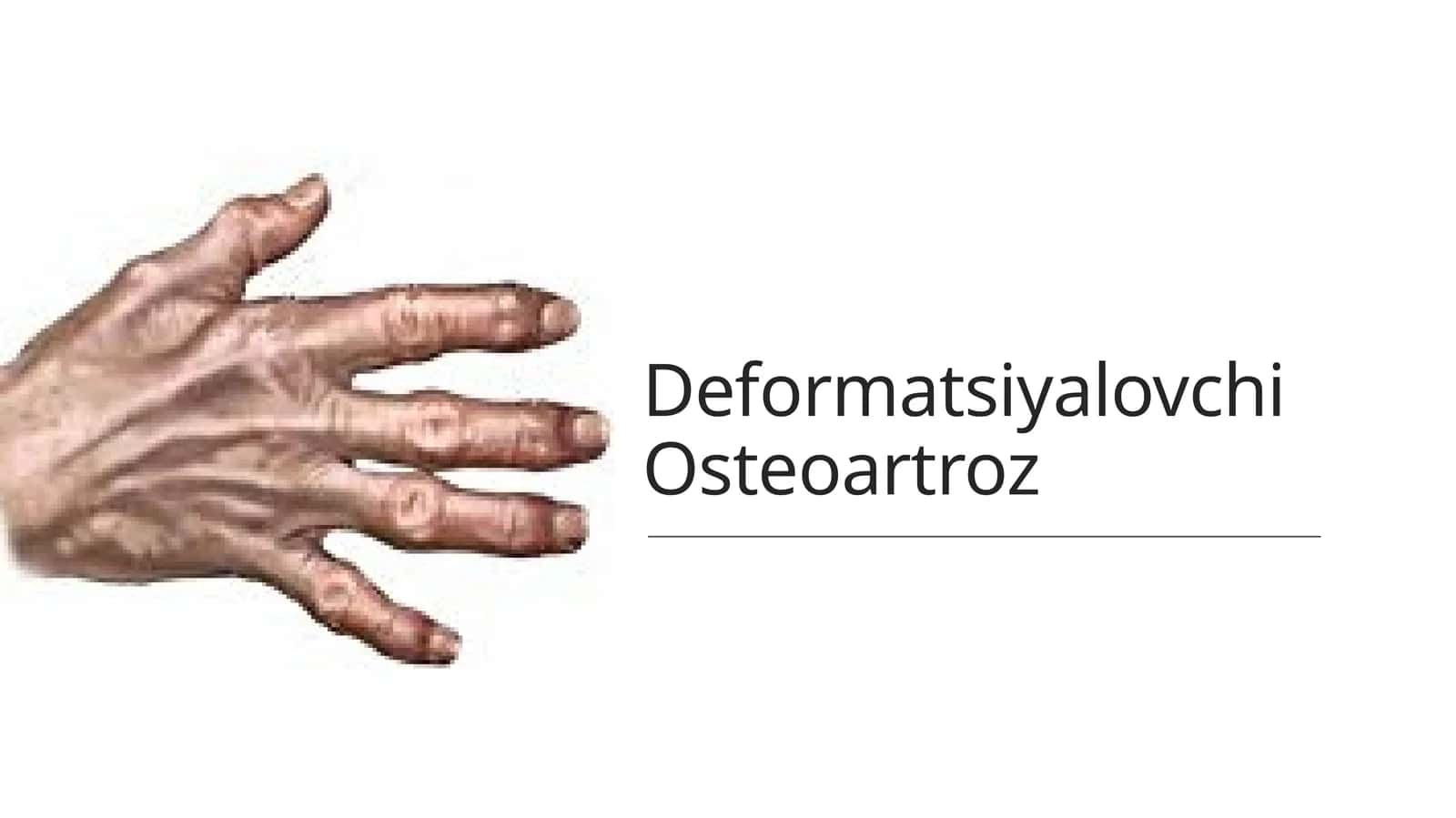 Deformatsiyalovchi Osteoartroz