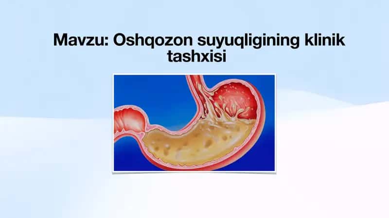 Oshqozon suyuqligining klinik tashxisi