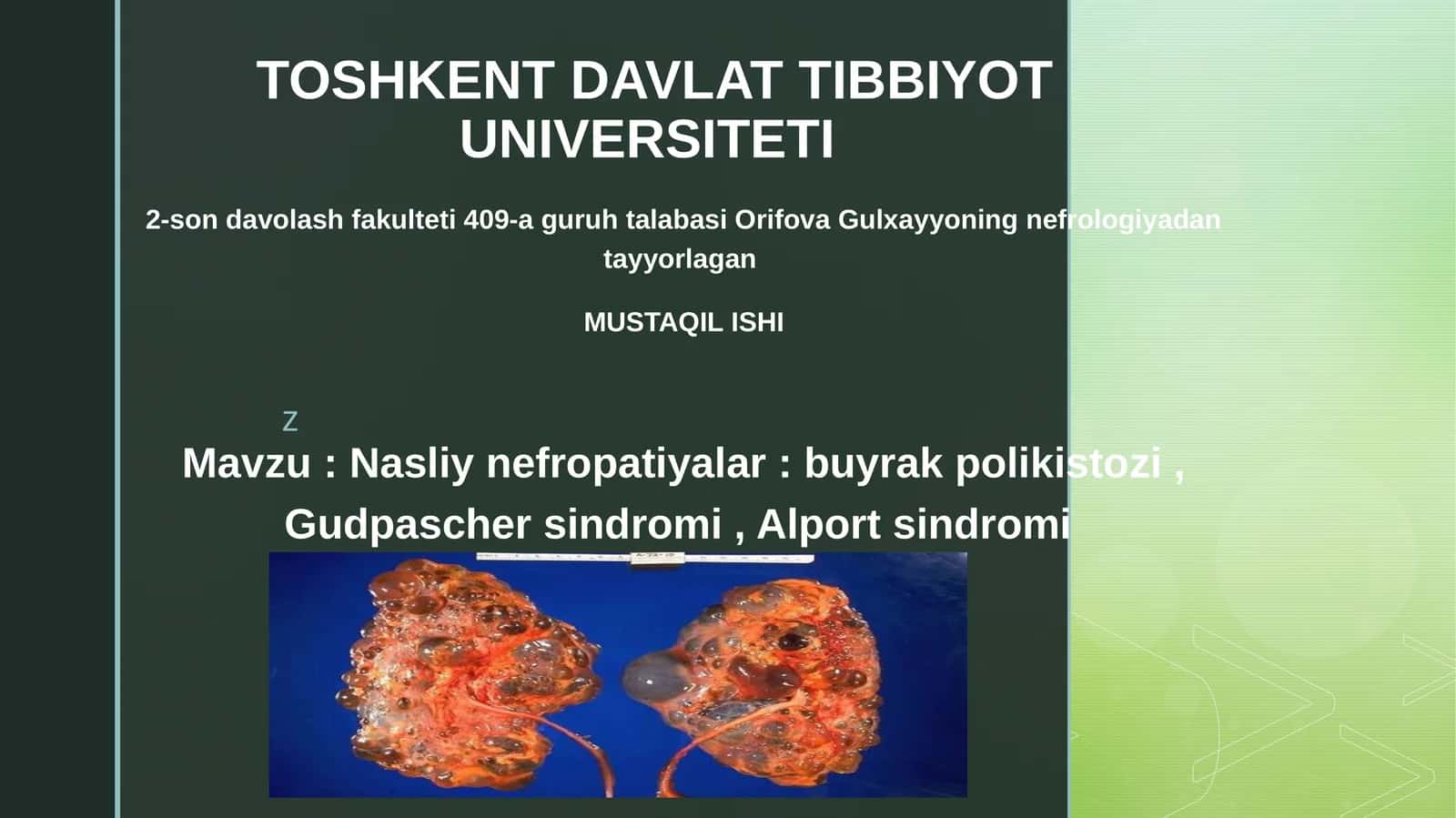 Nasliynefropatiyalar:buyrakpolikistozi,Gudpaschersindromi, Alportsindromi