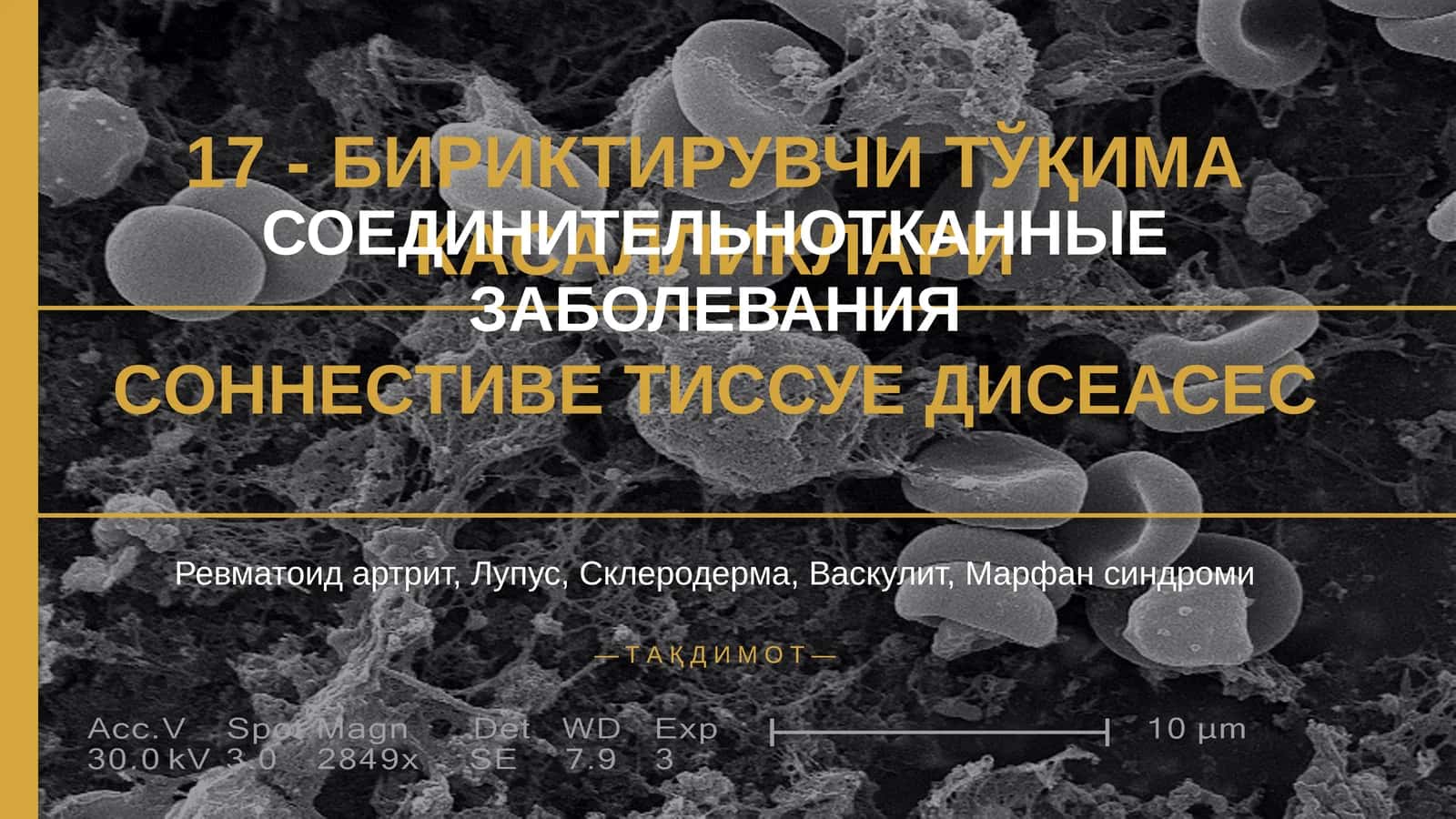 БИРИКТИРУВЧИ ТЎҚИМА КАСАЛЛИКЛАРИ